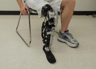 Ампутация ноги