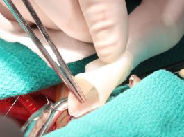 Создана артерия растущая вместе с хозяином