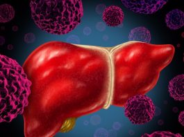 Ученые ищут подход к неалкогольному стеатогепатиту
