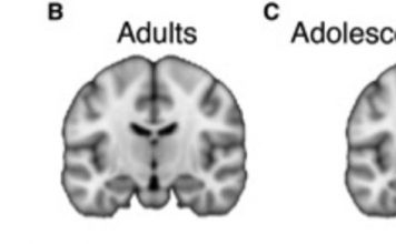 Подростковый мозг более эмоционально воспринимает информацию