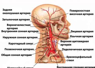 Операции на сонных артериях Артерии