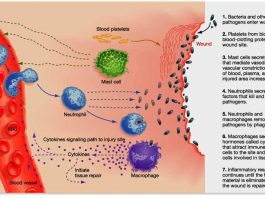 Воспаление