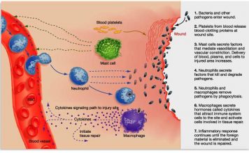 Воспаление
