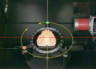 Сканеры для стоматологии — какие выбирать? Сканеры
