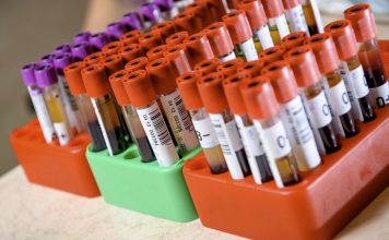 Ученые разработали новый метод раннего обнаружения аутизма