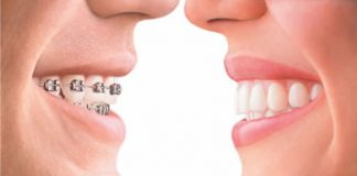 Ортодонтия