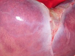 Циркадные ритмы могут увеличивать печень