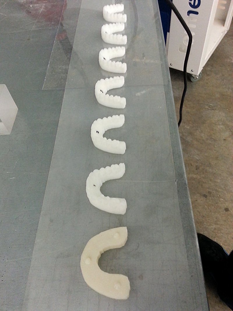 Студент исправил себе прикус, создав брекеты с помощью 3D-принтера