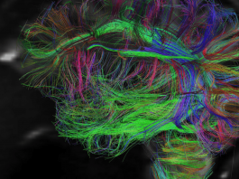 Нейрофизиологи утверждают, что забывать лишнюю информацию полезно