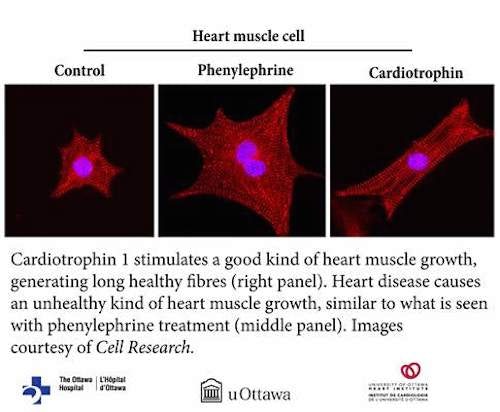 Ученые разработали новый метод лечения сердечной недостаточности