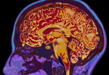 Ученые нашли вещество помогающее избавиться от нежелательных мыслей