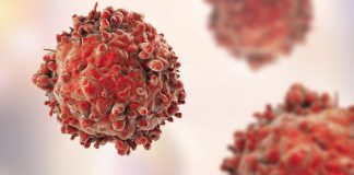 Раковые клетки