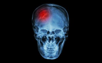 Ученые нашли связь между инфекциями и черепно-мозговыми травмами