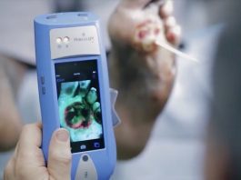 Разработано ручное устройство для обнаружения бактерий без анализов