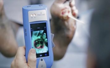 Разработано ручное устройство для обнаружения бактерий без анализов