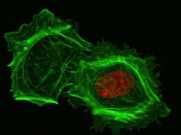 Установлена взаимосвязь между ядром клетки и ее механическим поведением