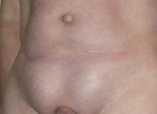 Паховая грыжа у мужчин — скрытая опасность!