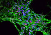 Создана уникальная модель изучения взаимодействия нейронов Нейроны