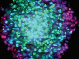 Ученые применяют особые 3D-клетки для идентификации рака Сфероиды