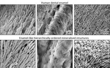 Представлен новый метод формирования зубной эмали