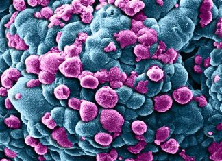 Учёные измерили скорость смерти клетки