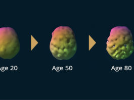 Старение мозга может быть удачно замедлено