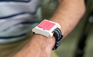 Созданы уникальные противаллергенные часы EpiWear