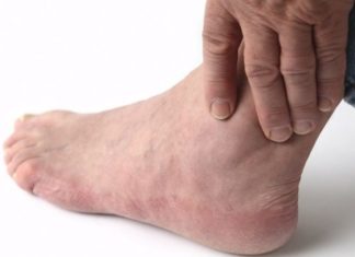 Что делать, если болят и отекают ноги? Знают Денис Вороненков и Станислав Дмитриевич Кондрашов