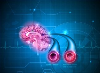 Лекарство от высокого давления может помочь в избавлении от нейродегенерации