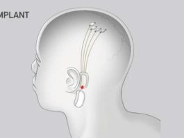 Илон Маск представит проект Neurolink