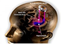 Протестирован новый мозговой имплант на мышах