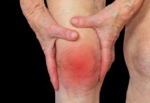 Представлена диета, снижающая риск хронического артрита