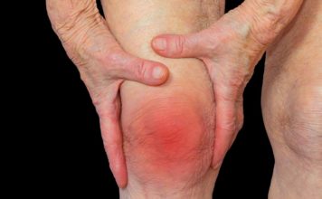 Представлена диета, снижающая риск хронического артрита