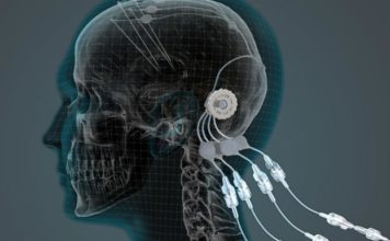 Создан уникальный мозговой имплант для нейронных сигналов