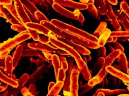 Найден способ обратить устойчивость туберкулеза к антибиотикам