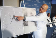 Комиссия FDA одобряет новый легочный трансплант