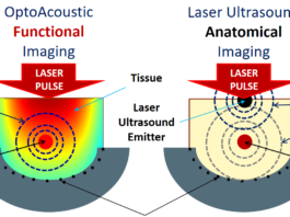 Созданы первые лазерно-ультразвуковые снимки
