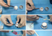 Изобретены контактные линзы для устранения повреждений глаз