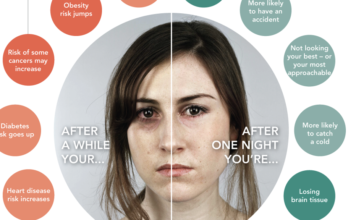 Депривация сна усиливает ощущение боли