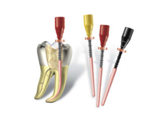 Достоинства инновационной системы Thermafil